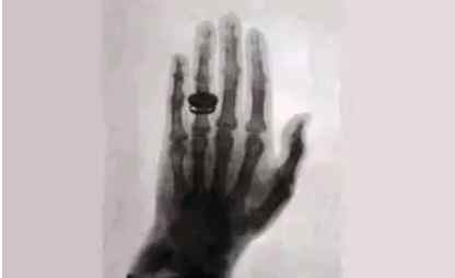 First X-ray  photo……