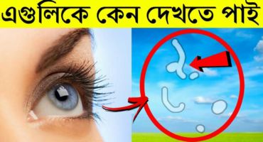চোখের সামনে এগুলি কি দেখা যায় What Are Those Floaty Things In Your Eye…? What Are Eye Floaters